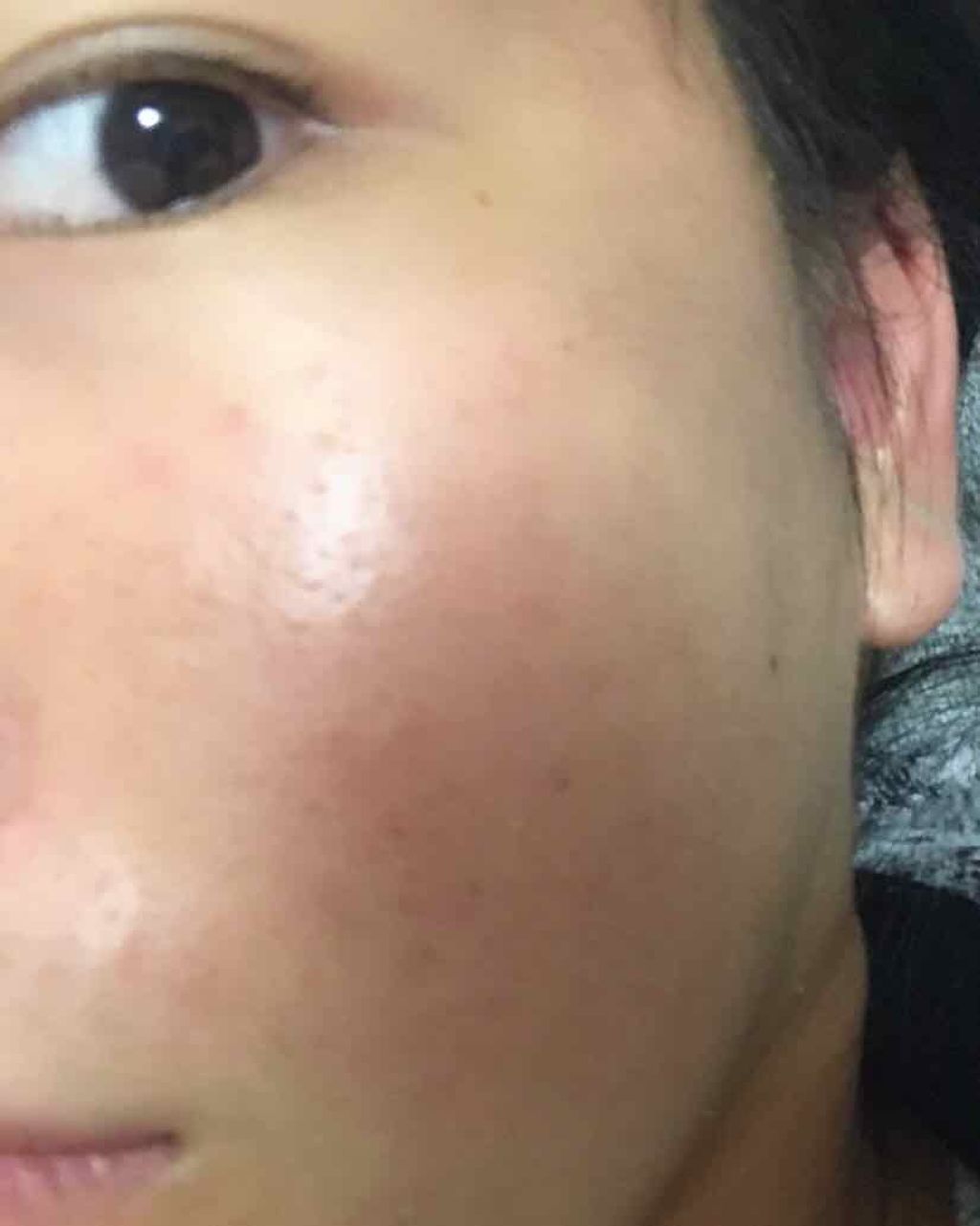 薬用しみ対策 美白化粧水/メラノCC/化粧水を使ったクチコミ（3枚目）