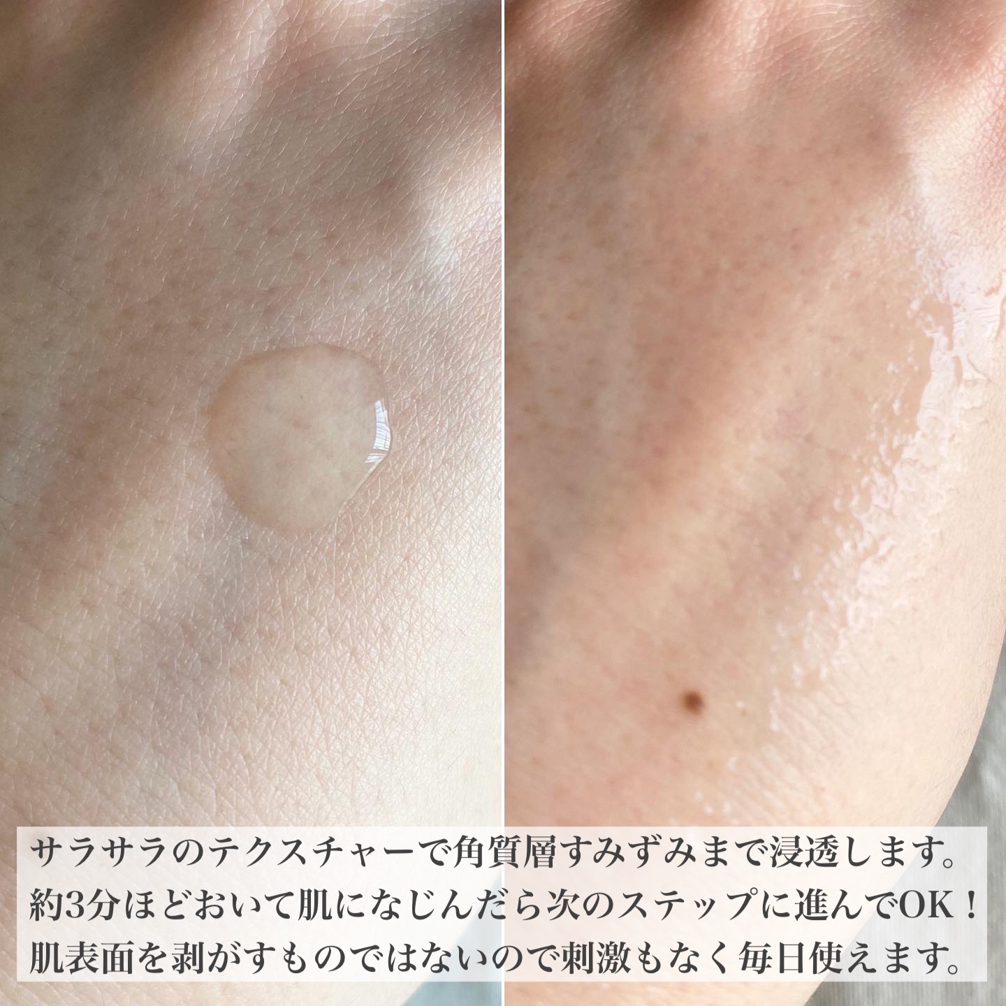 タカミスキンピール/タカミ/ブースター・導入液を使ったクチコミ（3枚目）