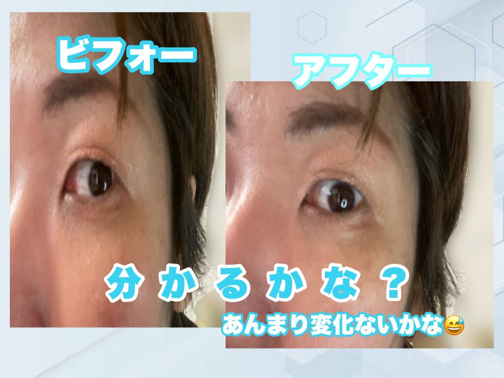 ふたえメッシュテープ/Eye Catching  Beauty/二重まぶた用アイテムを使ったクチコミ（3枚目）