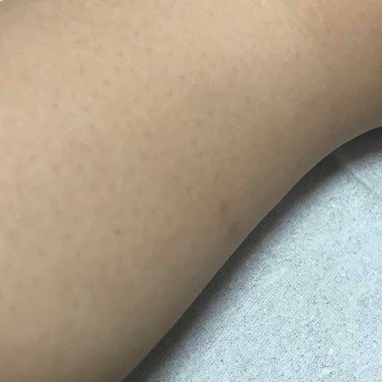 DHC はとむぎエキス/DHC/健康サプリメントを使ったクチコミ(4枚目)