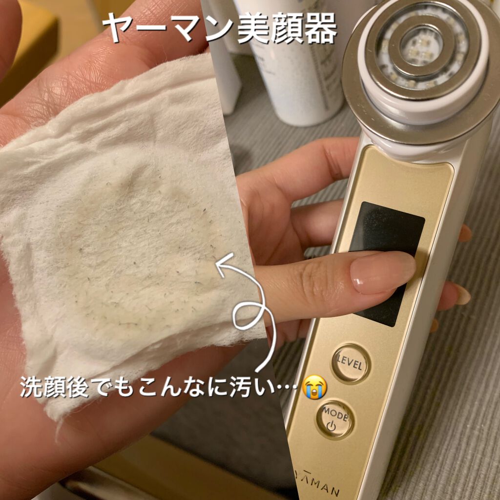 RFボーテ フォトPLUS EX/YA-MAN TOKYO JAPAN/美顔器・マッサージを使ったクチコミ(1枚目)