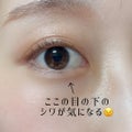 「やばい目の下のシワ、どうしたらいい?」20代からでも早すぎないシワ対策のサムネイル