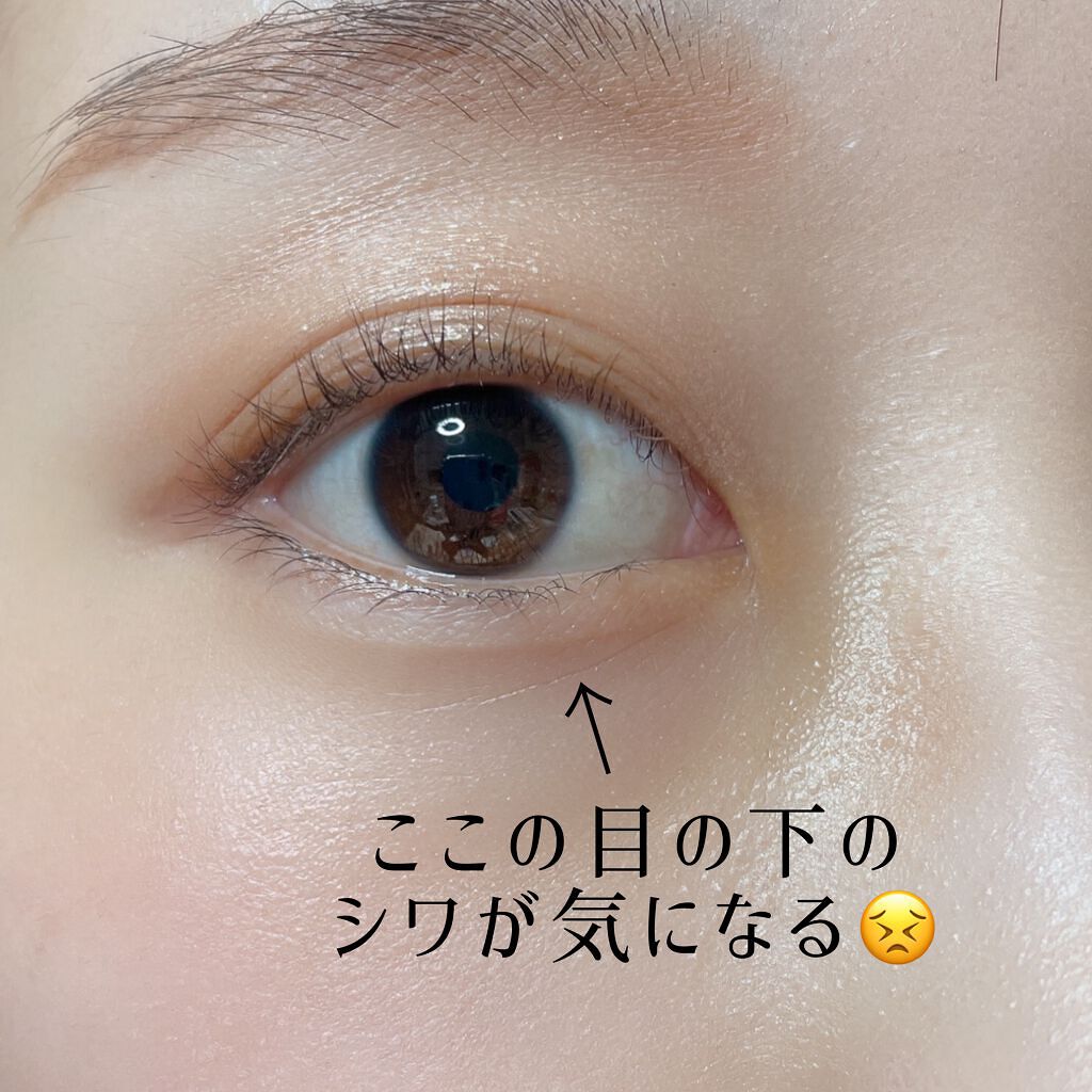 「やばい目の下のシワ、どうしたらいい?」20代からでも早すぎないシワ対策のサムネイル