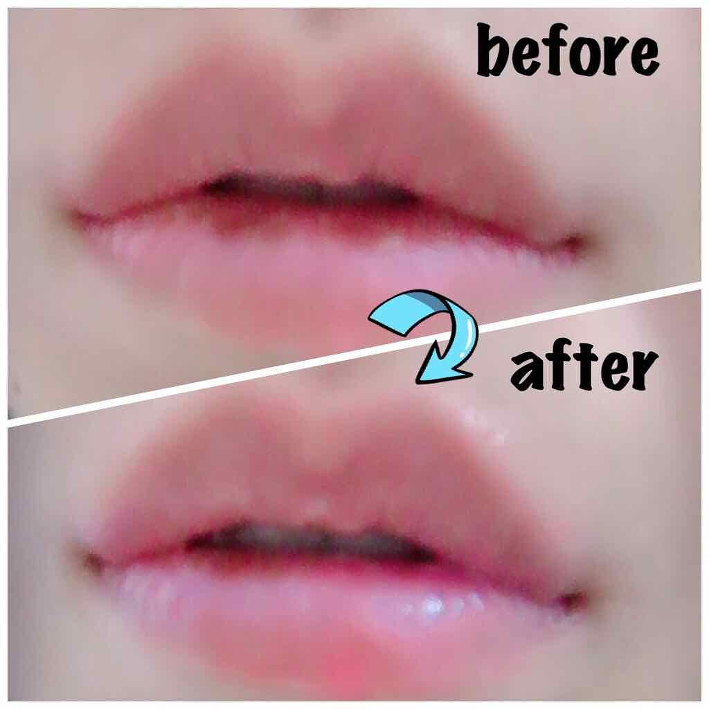 エッセンスリップバーム/VIVCO(ヴィヴコ）/リップバームを使ったクチコミ（3枚目）