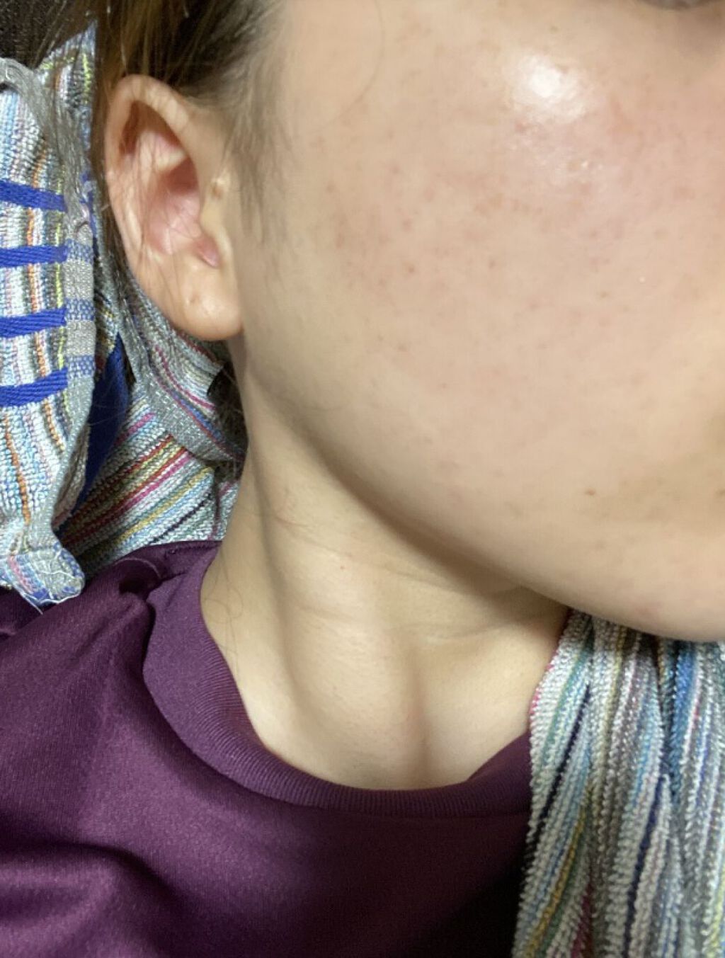 コンセントレート インジュビネーション マスク/ジュレリッチ/シートマスク・パックを使ったクチコミ（1枚目）