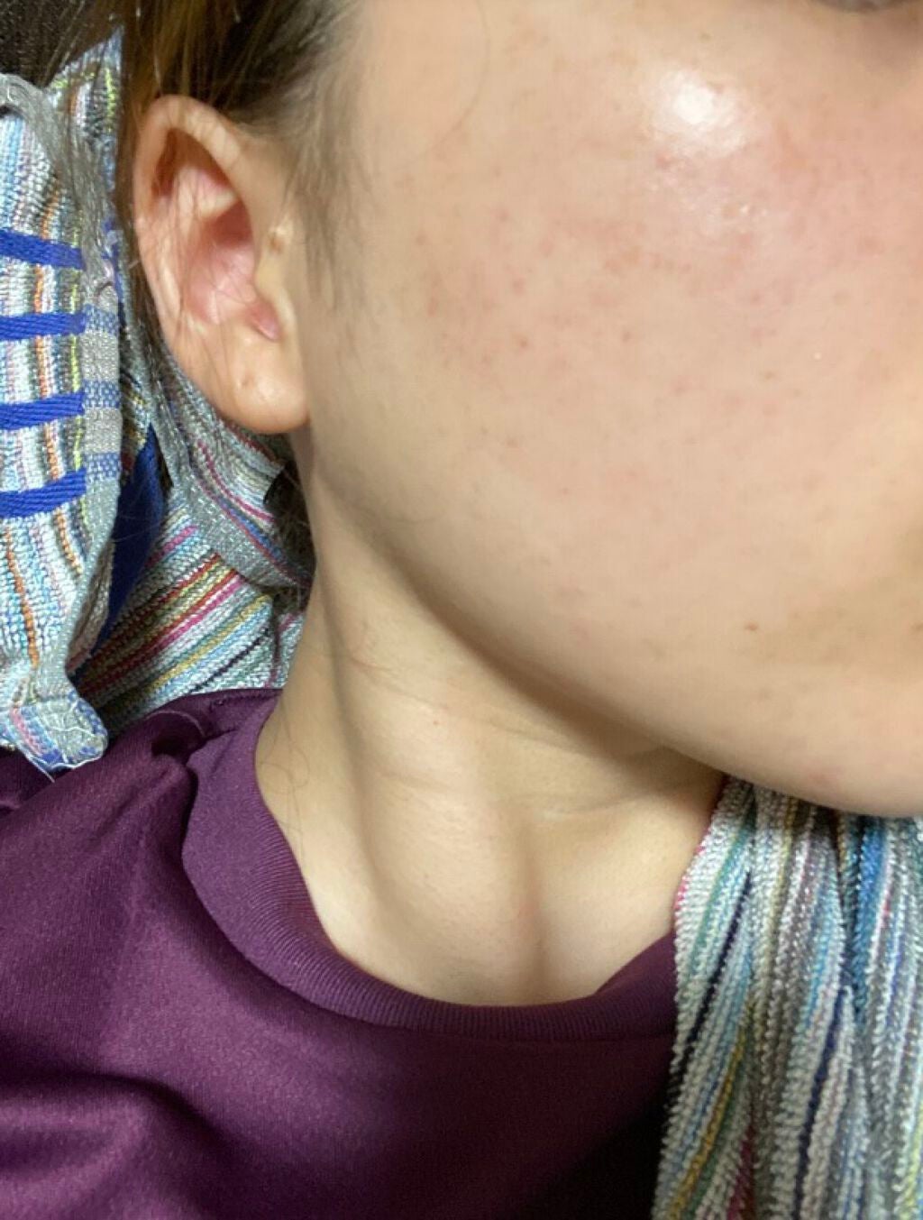 ホワイトニング ミスト セラム/アルージェ/ミスト状化粧水を使ったクチコミ(1枚目)