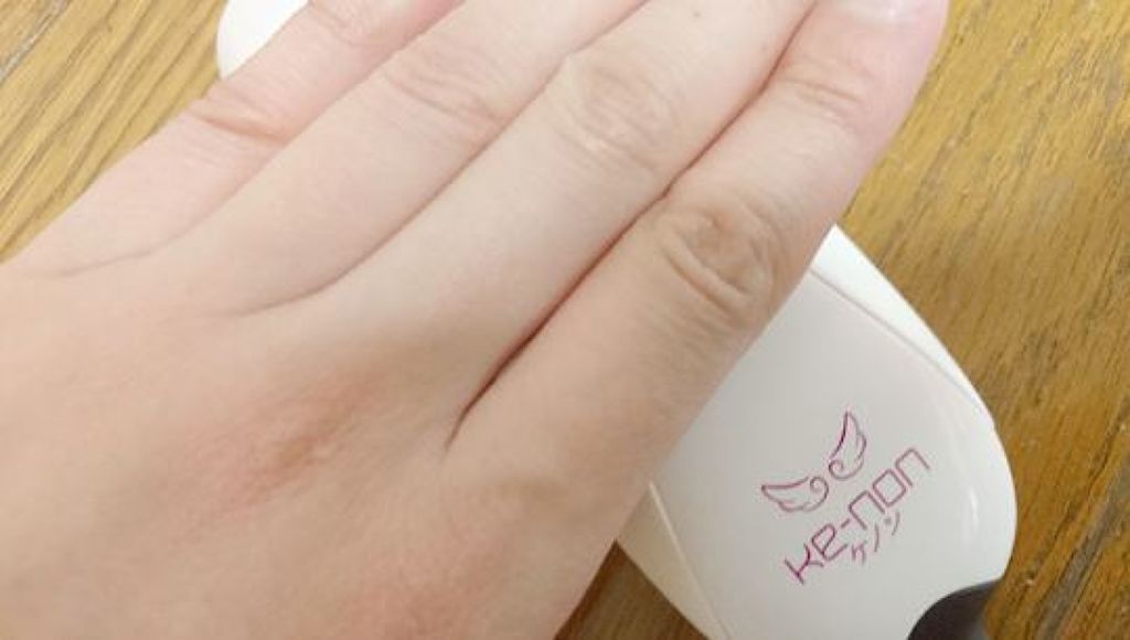 光美容器KE-NON(ケノン)/エムテック/家庭用脱毛器を使ったクチコミ(3枚目)