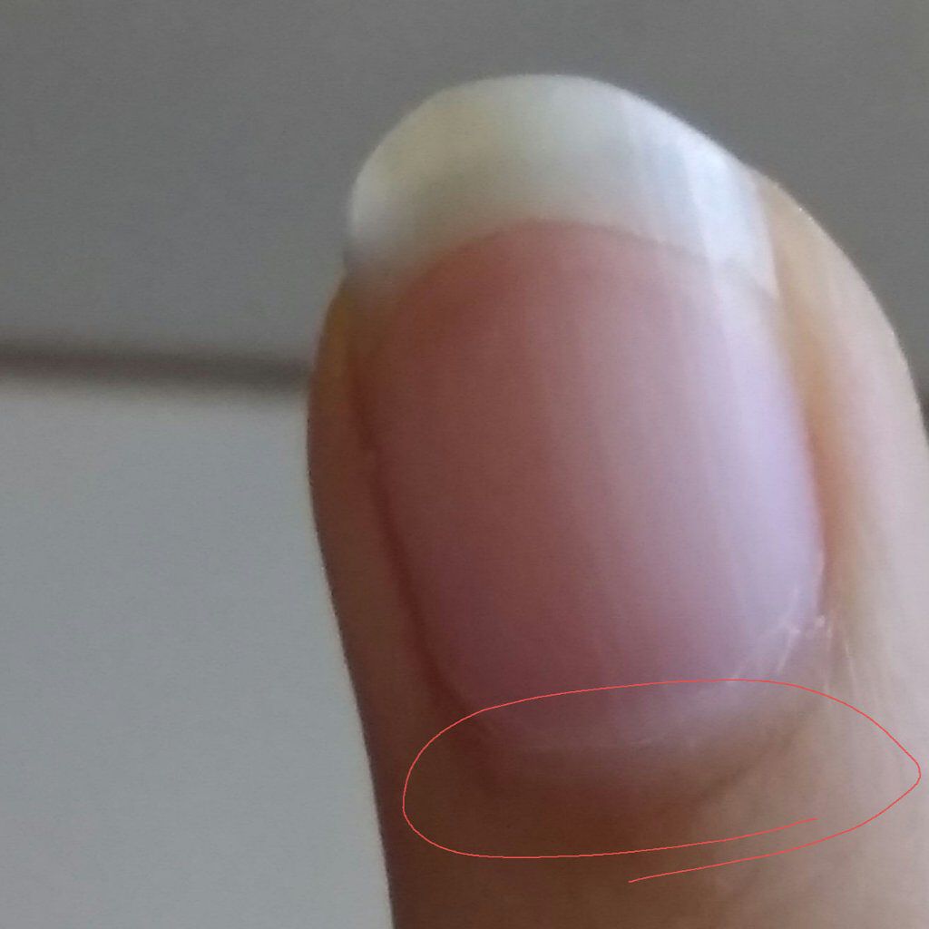 オリジナル ピュアスキンジェリー/ヴァセリン/ボディクリームを使ったクチコミ（2枚目）