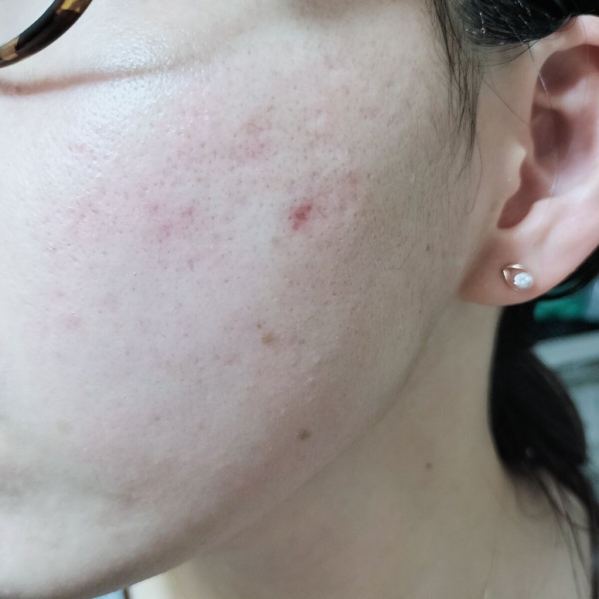 ナイアシンアミド美容液/InstaNatural/美容液を使ったクチコミ（2枚目）