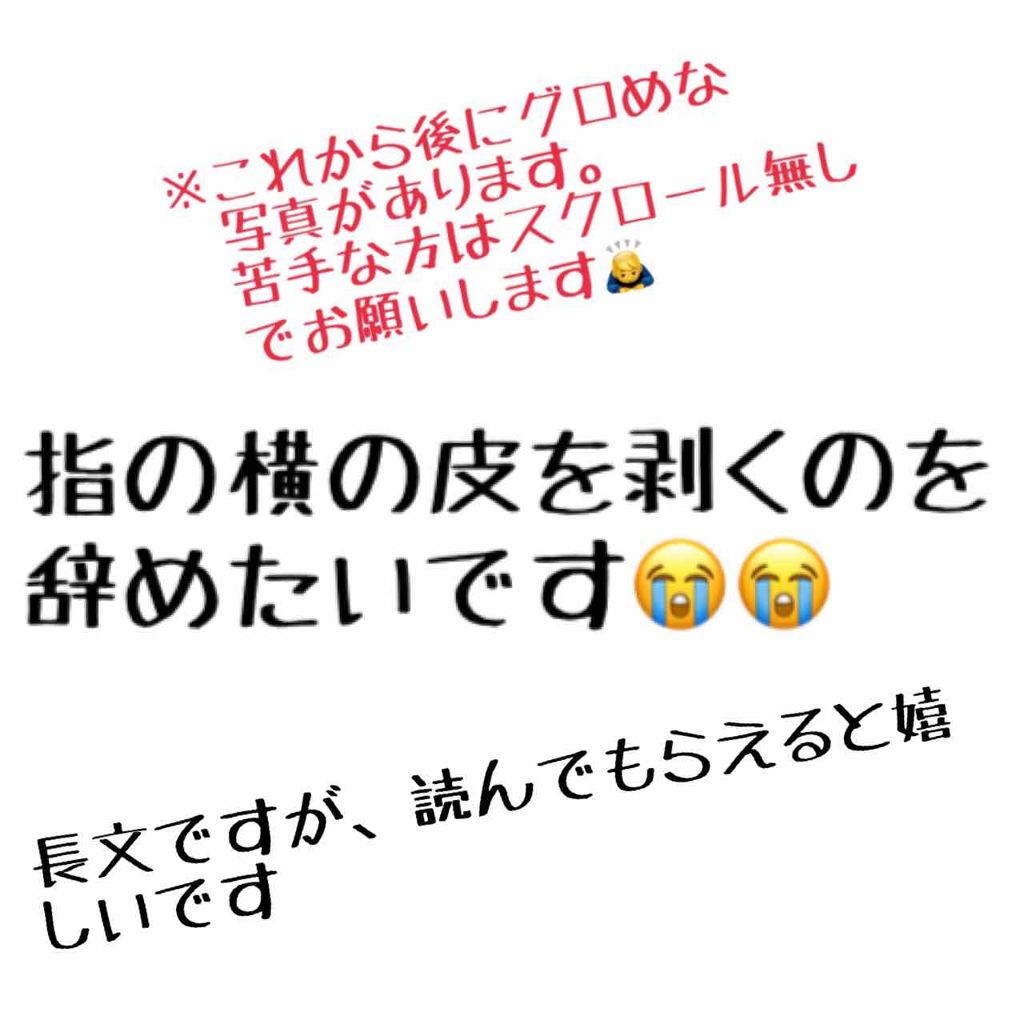 ニベアクリーム/ニベア/ボディクリームを使ったクチコミ（1枚目）