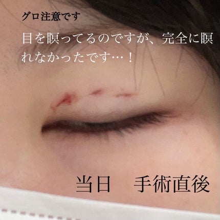 すぅ on LIPS 「私は、4年前から少しずつプチ整形も含めて、整形しています!20..」(4枚目)