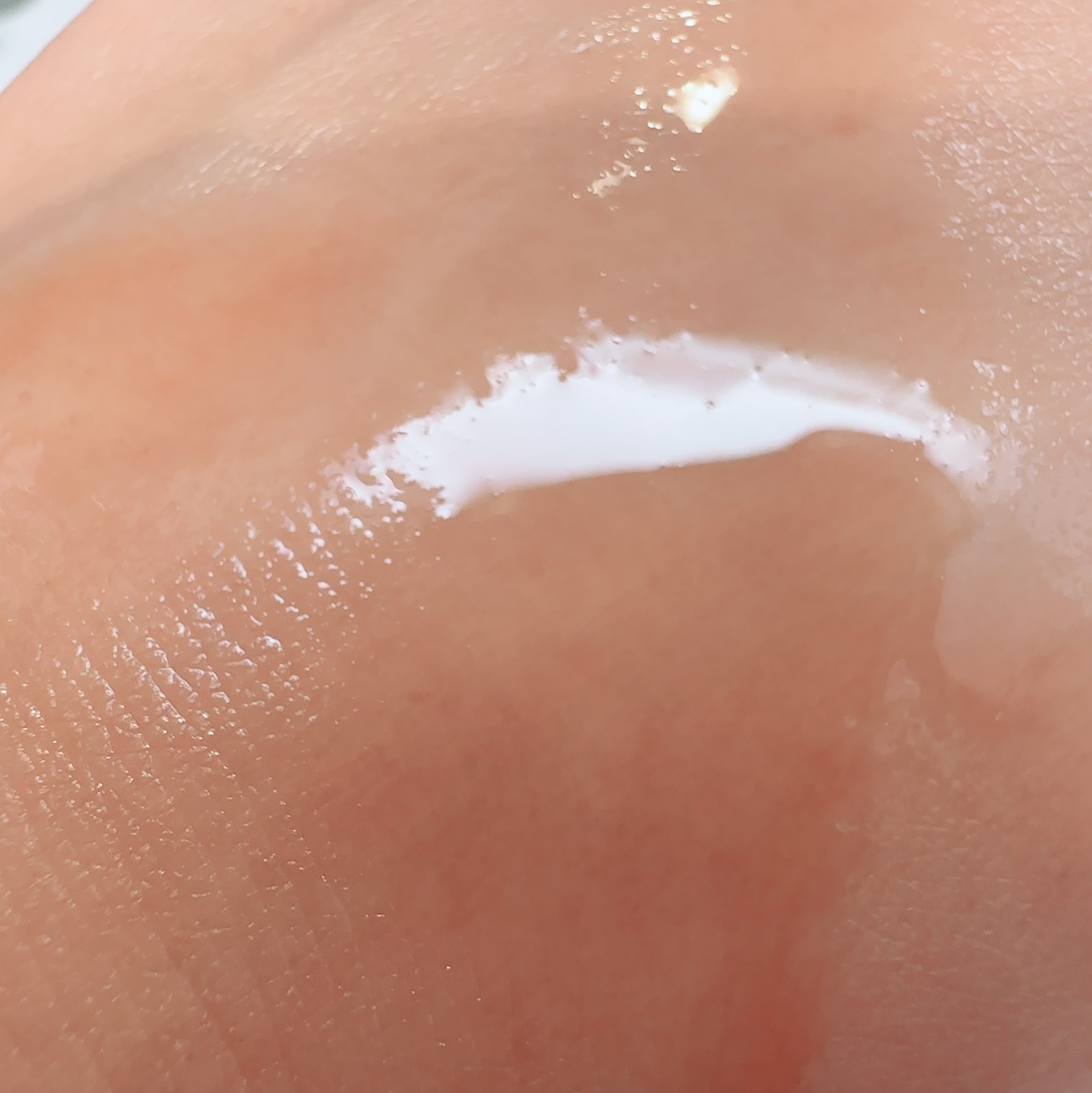 ボディアクネピーリングショット/MEDICUBE/ネック・デコルテケアを使ったクチコミ（2枚目）