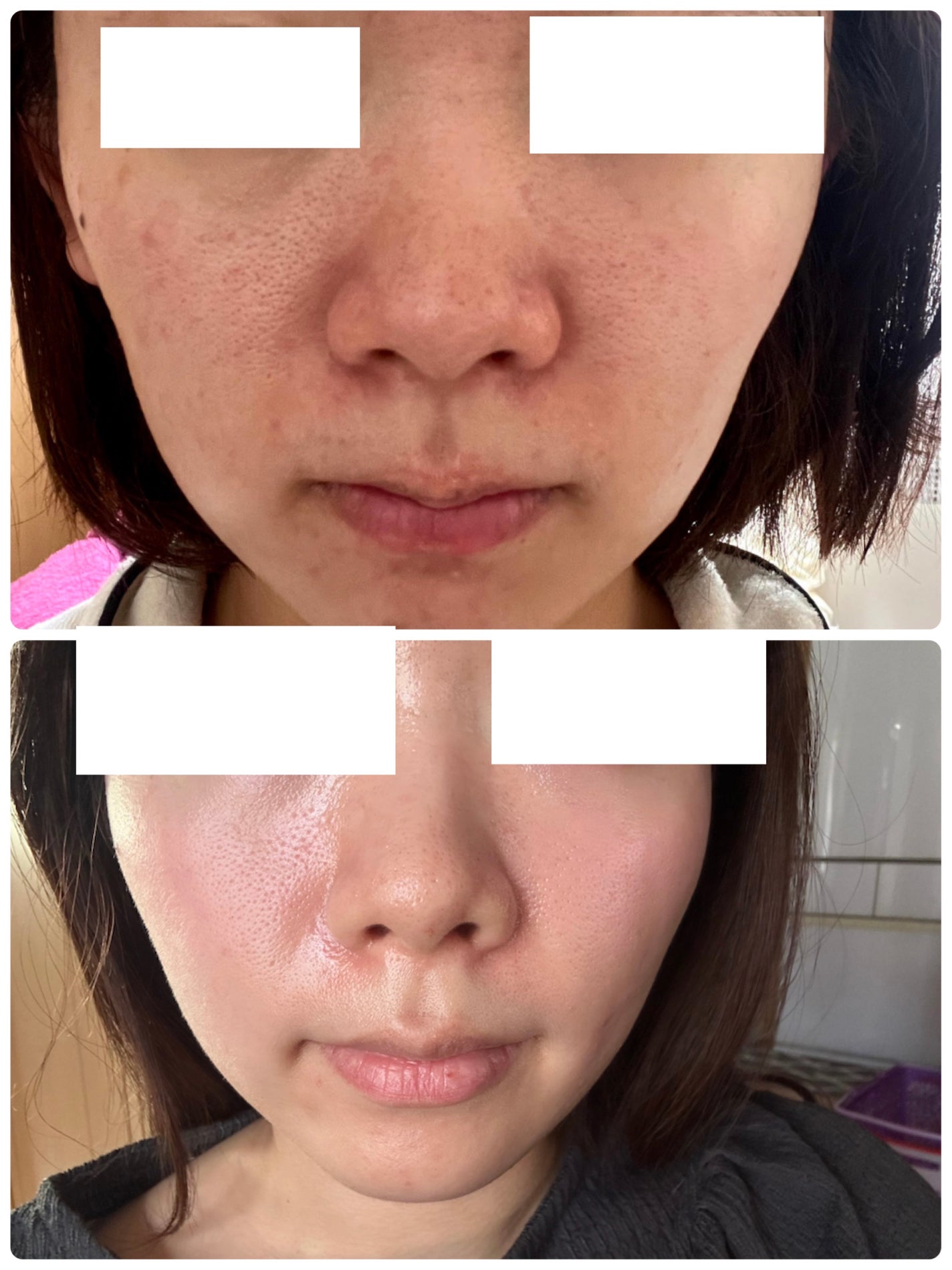 N10+Z1フェイスセラム /The Ordinary/美容液を使ったクチコミ(1枚目)