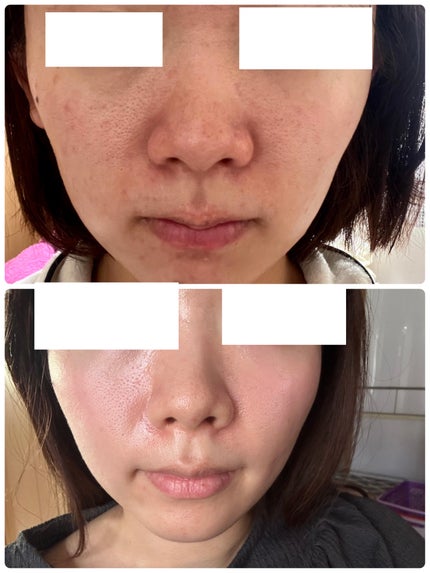 N10+Z1フェイスセラム /The Ordinary/美容液を使ったクチコミ(1枚目)