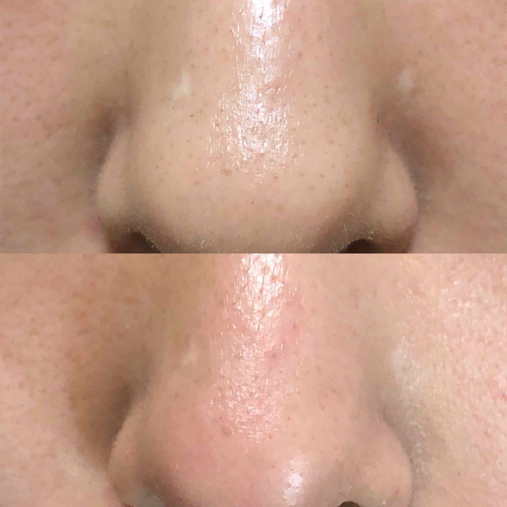 JUSO KURO PACK/NAKUNA-RE/洗い流すパック・マスクを使ったクチコミ（2枚目）