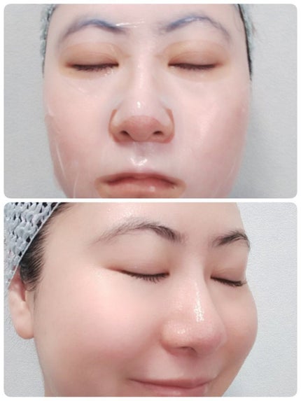 グロウセラム マスク/ルミナスキン/シートマスク・パックを使ったクチコミ(5枚目)