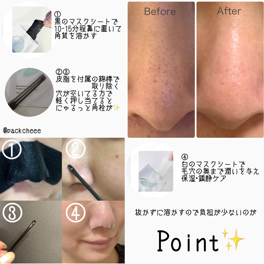 ブラック ヘッド ゼロ ２ステップ ノーズ パッチ/Dr.Althea/シートマスク・パックを使ったクチコミ（1枚目）