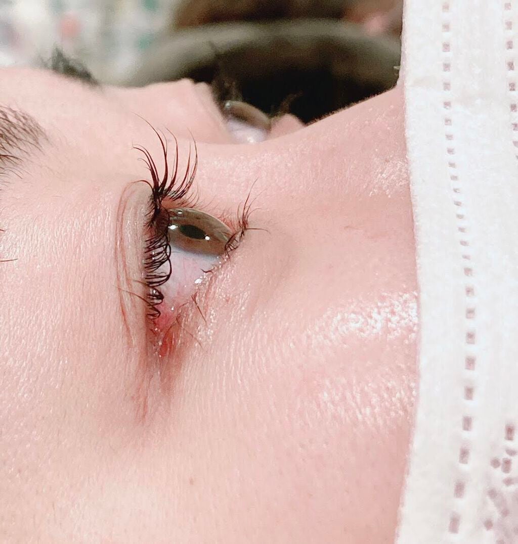 エグータム/アルマダスタイル/まつげ美容液を使ったクチコミ(4枚目)