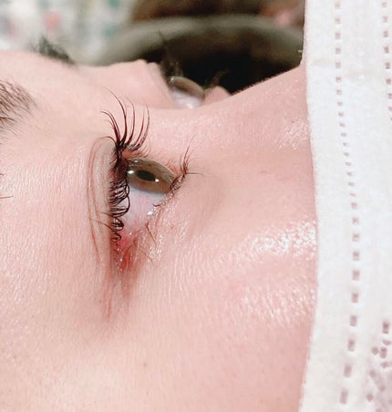 エグータム/アルマダスタイル/まつげ美容液を使ったクチコミ(4枚目)