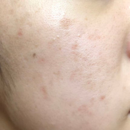 クリアモイスチャー M(しっとりタイプ)/オルビス/乳液を使ったクチコミ(2枚目)