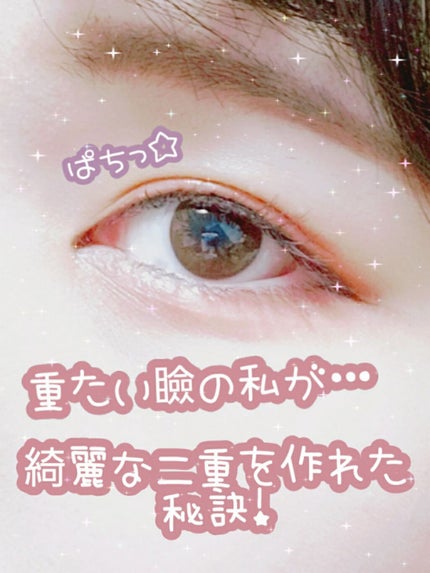アイビューティー フィクサー WP/アストレア ヴィルゴ/二重まぶた用アイテムを使ったクチコミ(1枚目)