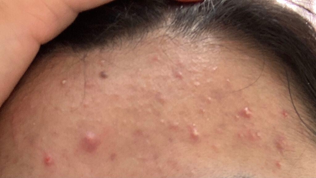 モイストローション/WHOMEE/化粧水を使ったクチコミ(2枚目)