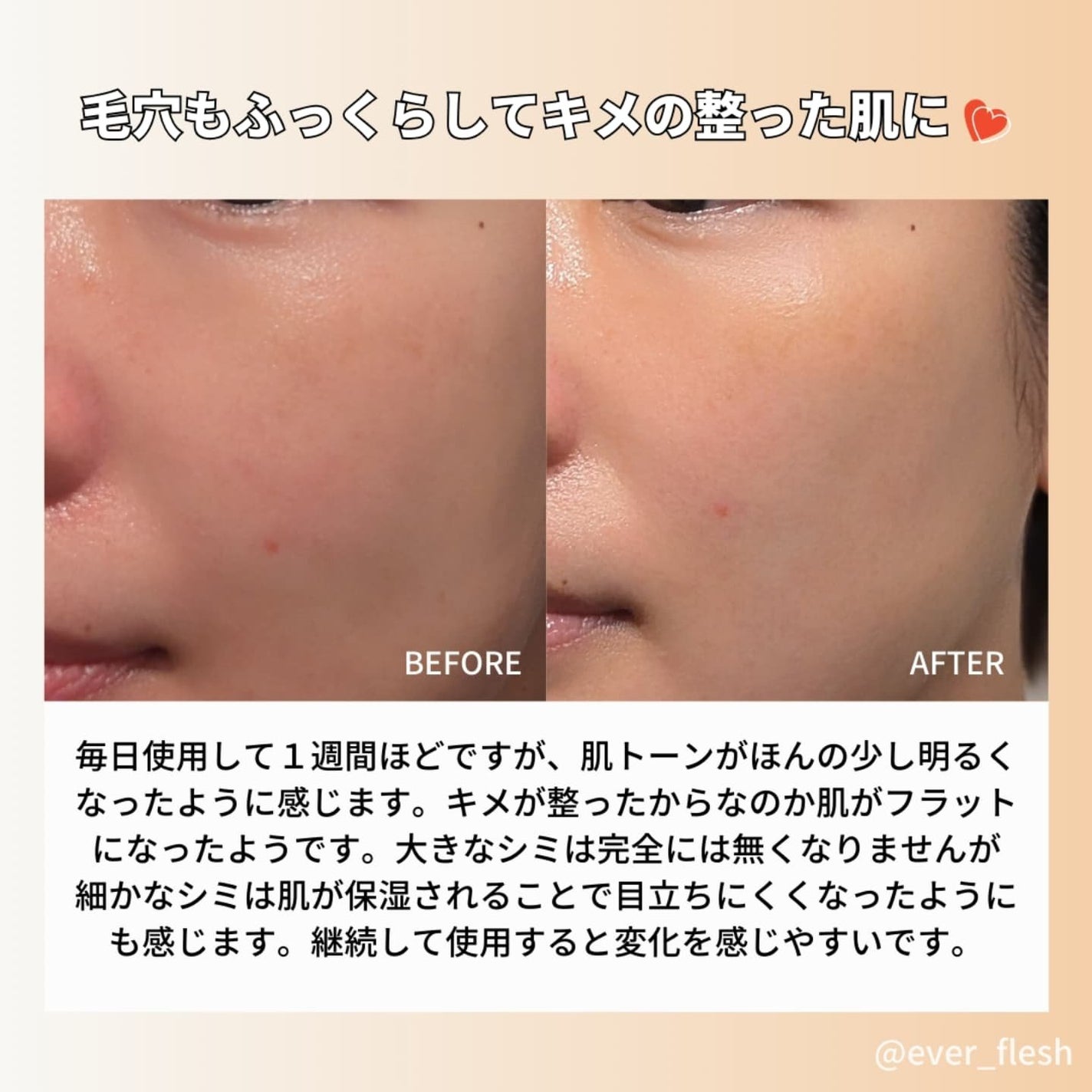 グルタミン抗酸化光彩セラム/make prem/美容液を使ったクチコミ(5枚目)