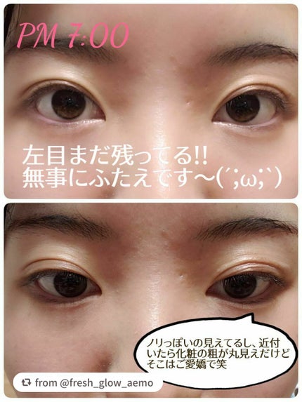 アイトーク スーパーウォータープルーフ/アイトーク/二重まぶた用アイテムを使ったクチコミ(5枚目)