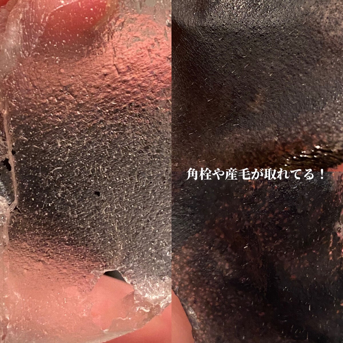 毛穴小町 ブラックピールオフパック/クリアターン/ピーリングを使ったクチコミ(2枚目)