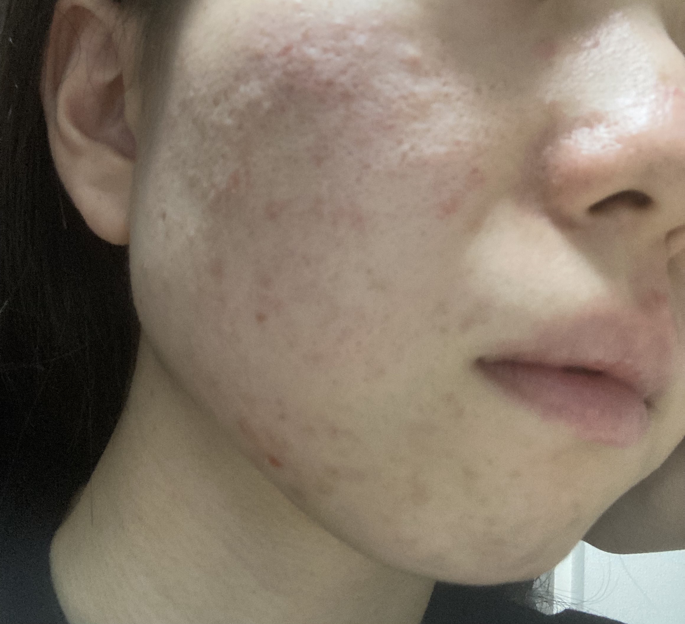 ACアクティブ クレンジングリキッド/NOV/クレンジングウォーターを使ったクチコミ（1枚目）