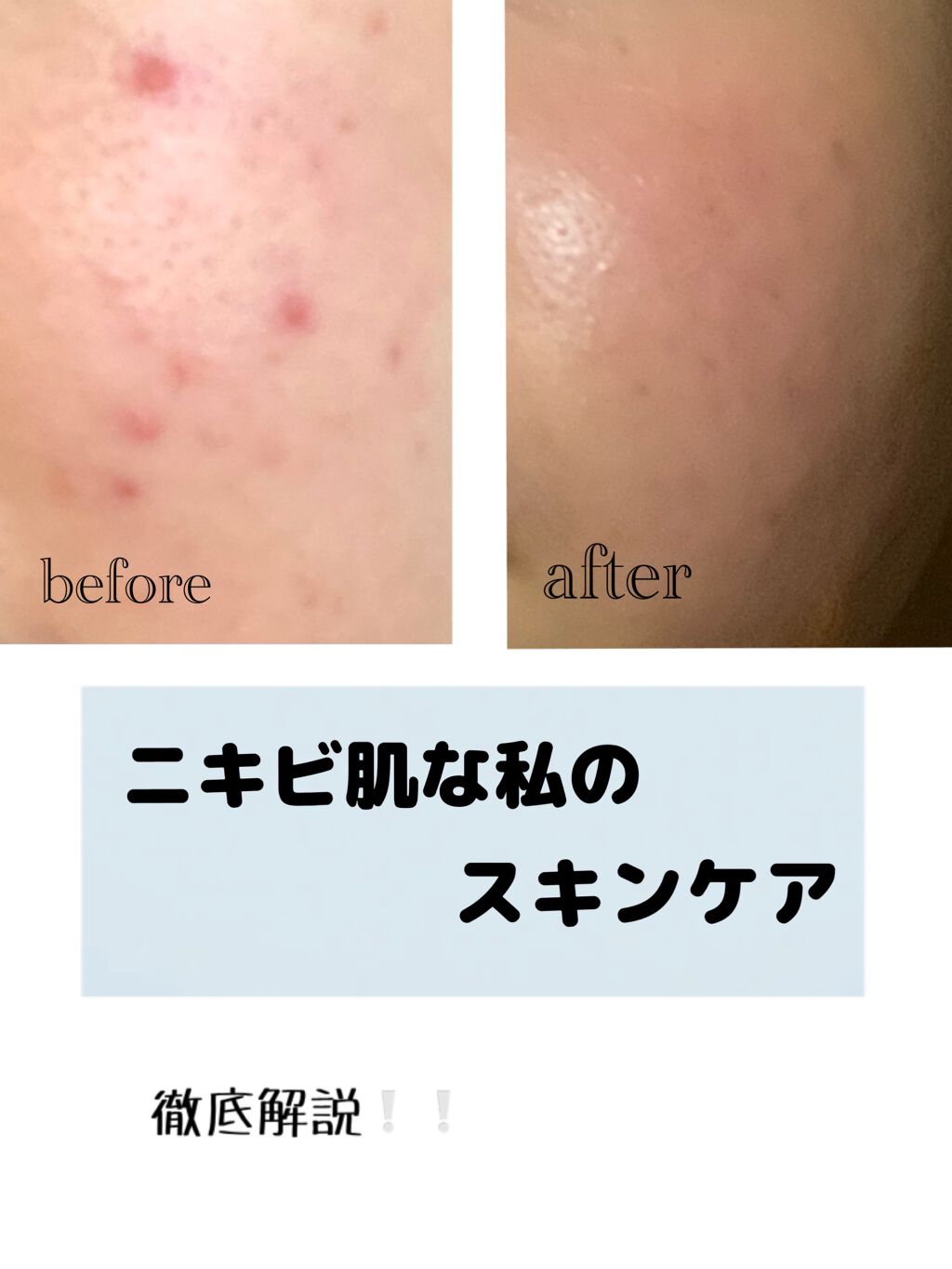 洗顔用泡立てネット/無印良品/その他スキンケアグッズを使ったクチコミ（1枚目）