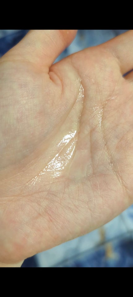 薬用 メディカル アンチヘアロスセラム/L'OCCITANE/頭皮ローションを使ったクチコミ(5枚目)