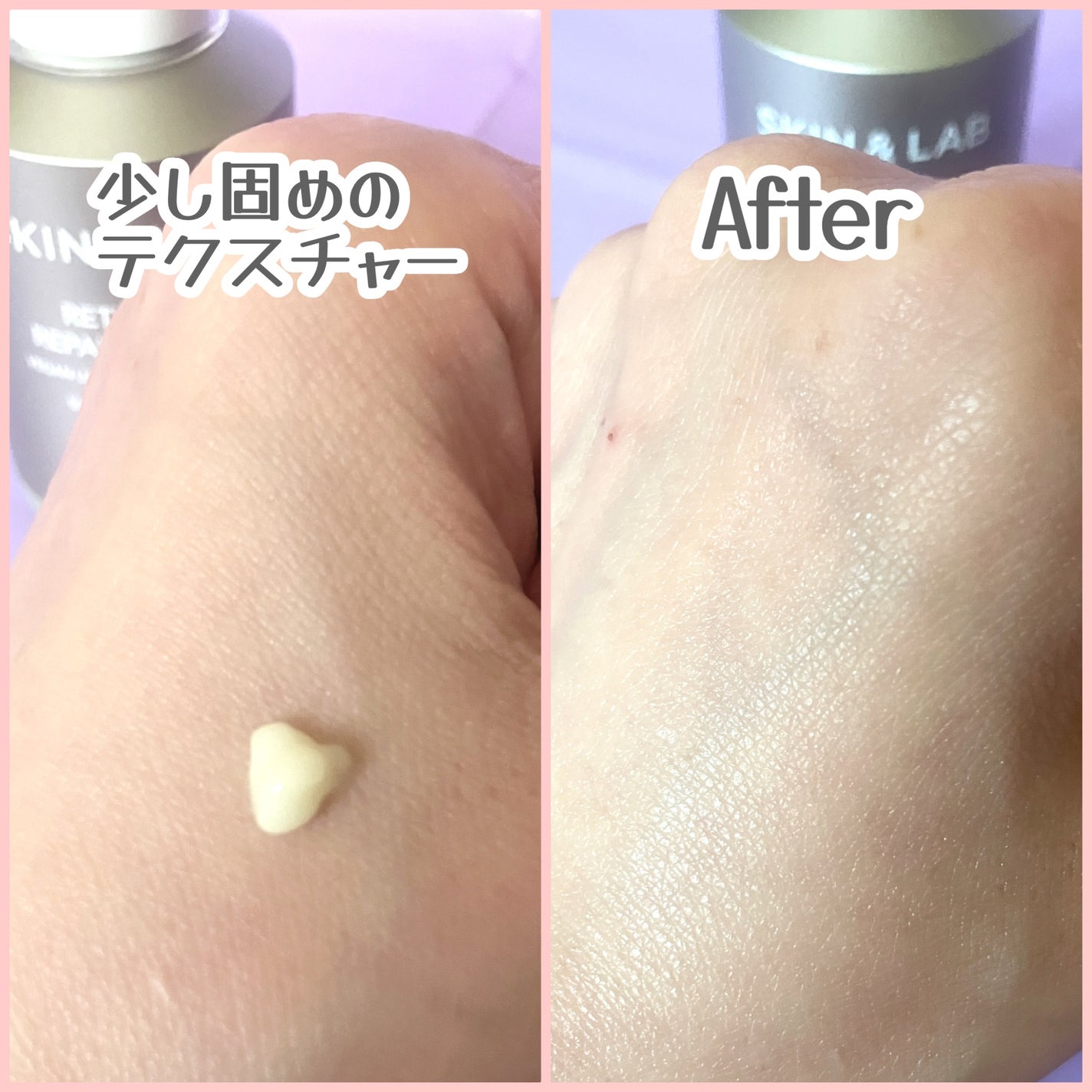 ヴィーガンリポソームレチノールセラム/SKIN&LAB/美容液を使ったクチコミ(5枚目)