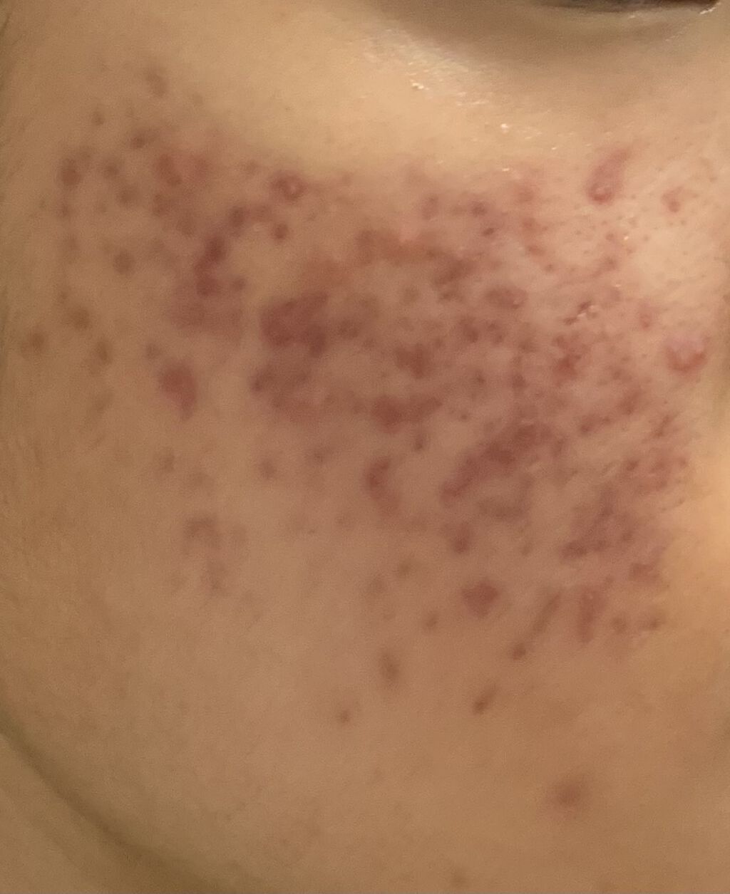 DHC マルチビタミン/DHC/美容サプリメントを使ったクチコミ（2枚目）