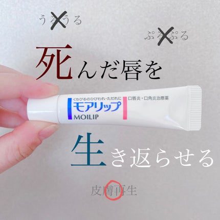 モアリップ N (医薬品)/資生堂薬品/その他を使ったクチコミ(1枚目)