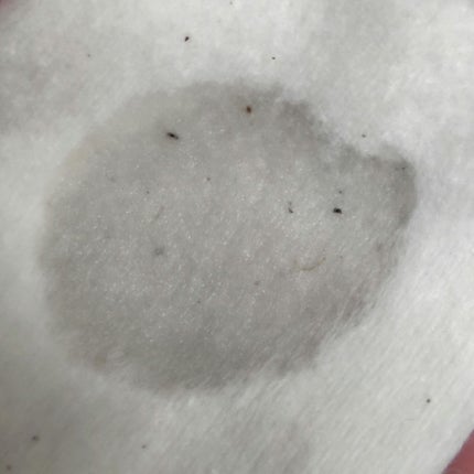 オードムーゲ 薬用ローション(ふきとり化粧水)/オードムーゲ/拭き取り化粧水を使ったクチコミ(2枚目)