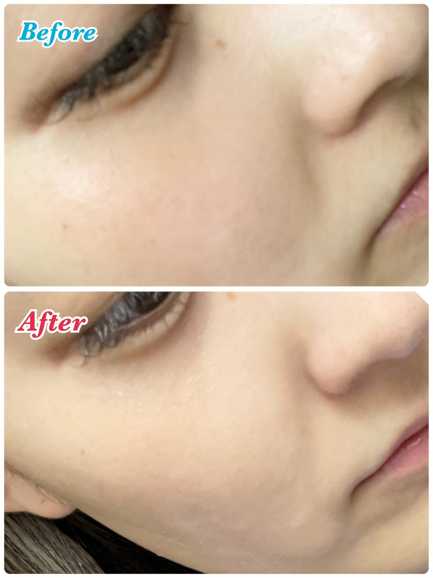 CICA デイリースージングマスク/VT/シートマスク・パックを使ったクチコミ(4枚目)