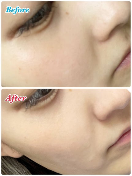 CICA デイリースージングマスク/VT/シートマスク・パックを使ったクチコミ(4枚目)