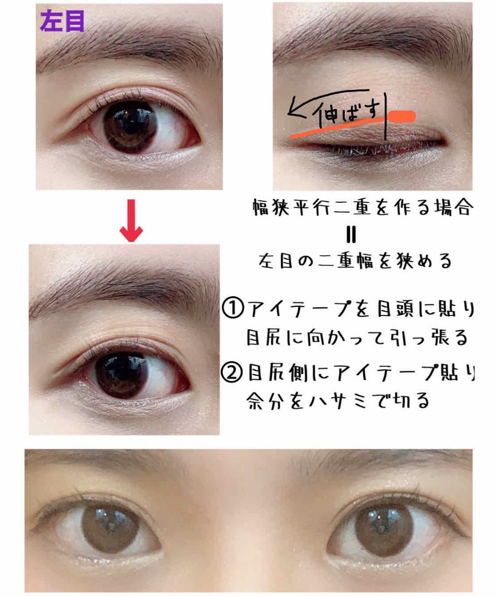 のびーるアイテープ(絆創膏タイプ、レギュラー)/DAISO/二重まぶた用アイテムを使ったクチコミ(2枚目)