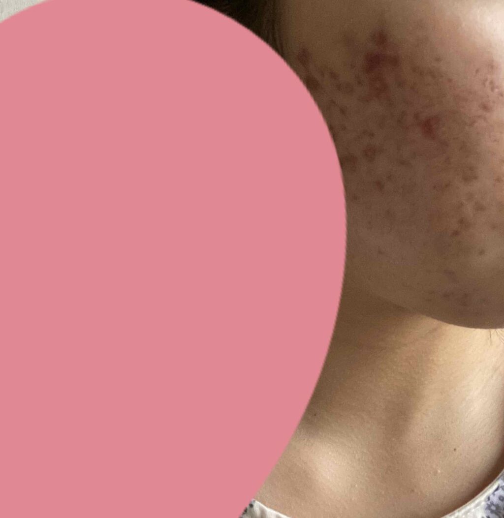 可愛くなりたい on LIPS 「注意⚠️自分用記録嫌になる何すればいいの〜〜..」(2枚目)