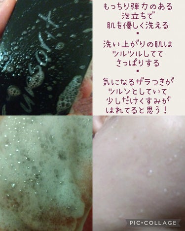 スキンピールバー ハイドロキノール/サンソリット/洗顔石鹸の画像