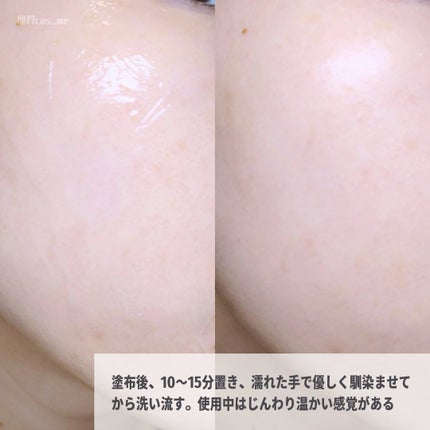 BFTパック/R-FACE/洗い流すパック・マスクを使ったクチコミ(4枚目)