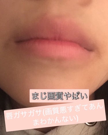 うずらチ    フォロバ on LIPS 「おはこんばんはうずらチです！今日はキャスキッドソンのリップクリ..」（1枚目）