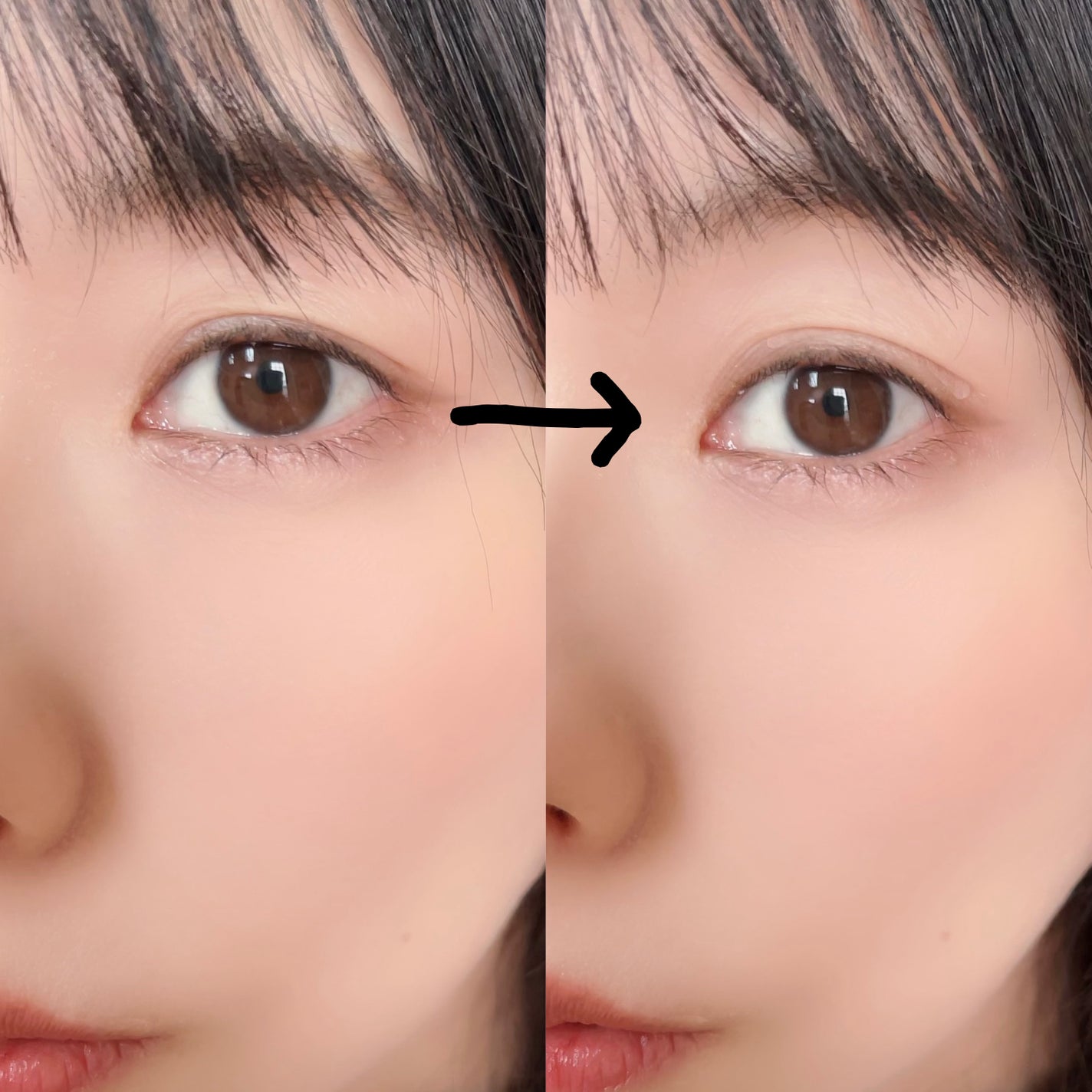 のびる透明アイテープ/キャンドゥ/二重まぶた用アイテムを使ったクチコミ(2枚目)