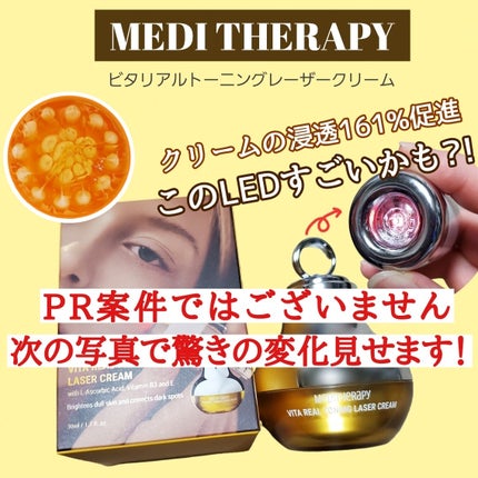 ビタリアルトーニングレーザークリーム/MEDITHERAPY/フェイスクリームを使ったクチコミ(1枚目)