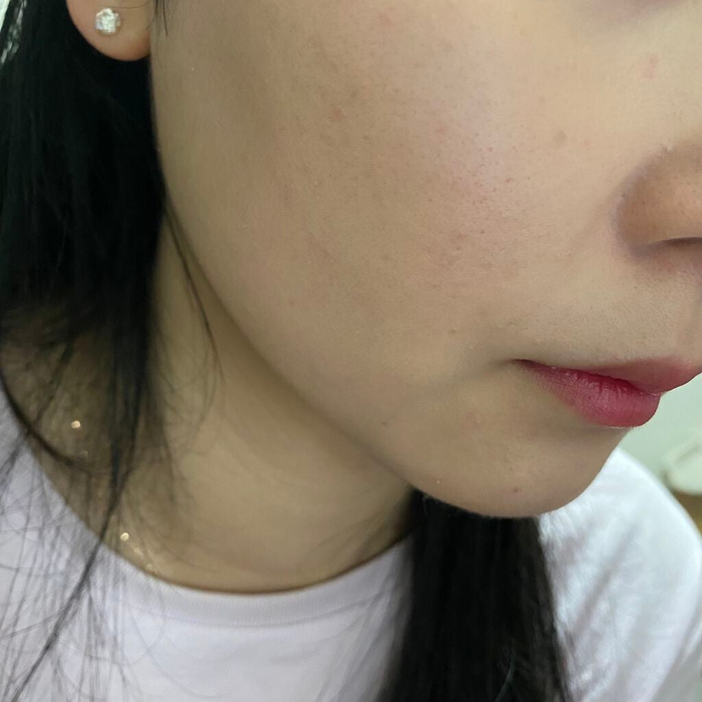 シルキーステイファンデーション/HERA/リキッドファンデーションを使ったクチコミ(5枚目)
