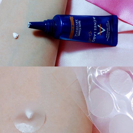 薬用ニキビケア スポッツクリーム/アクネスラボ/フェイスクリームを使ったクチコミ(1枚目)