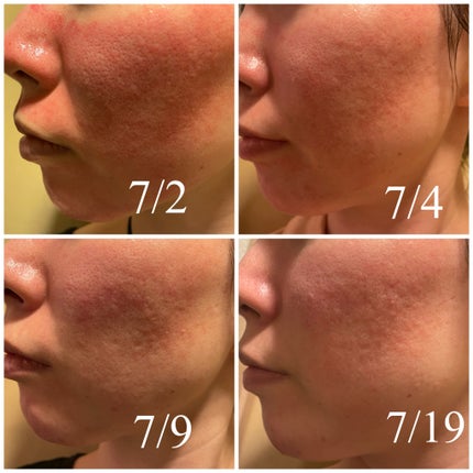 を使ったクチコミ(1枚目)