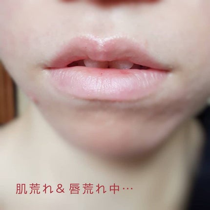 モイスチャーカラーリップ/コラリッチ/口紅を使ったクチコミ(6枚目)