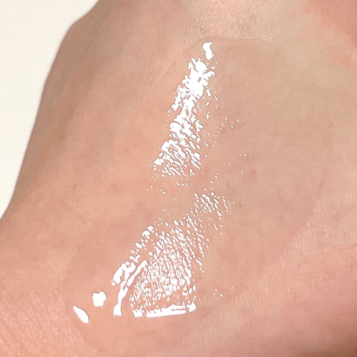 ブレミッシュケアアップ セラム/ISOI/美容液を使ったクチコミ(3枚目)